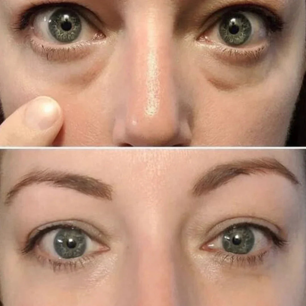 Facial Lifting Beauty Eye Pad